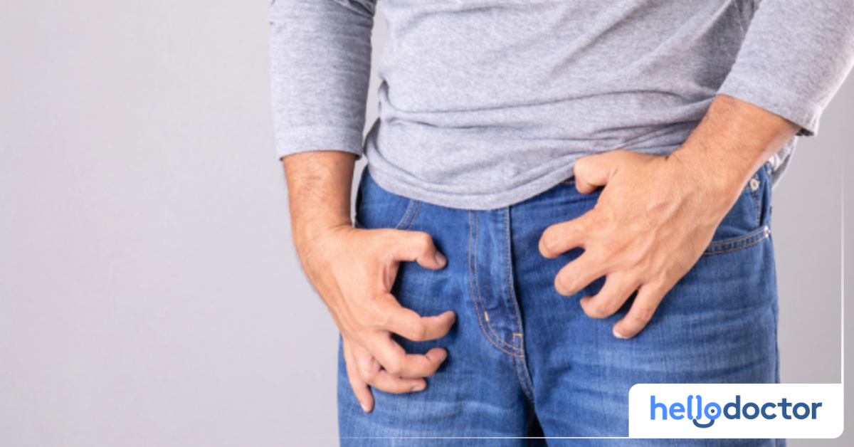 Jock Itch Causes and Symptoms How to Check for Hadhad?
