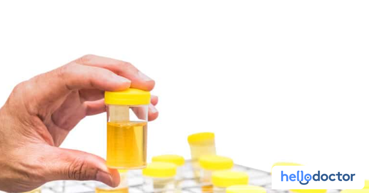 How To Read Urinalysis Results for UTI What You Should Know