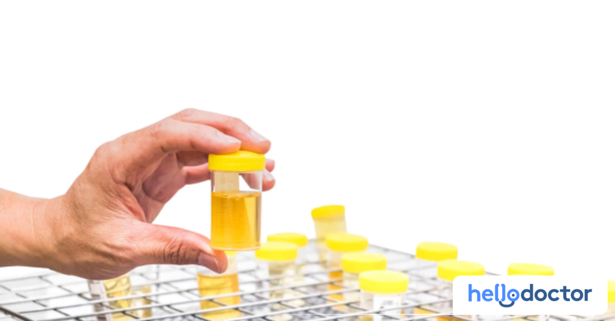 Alamin Mga mobile medical laboratory sa Pilipinas