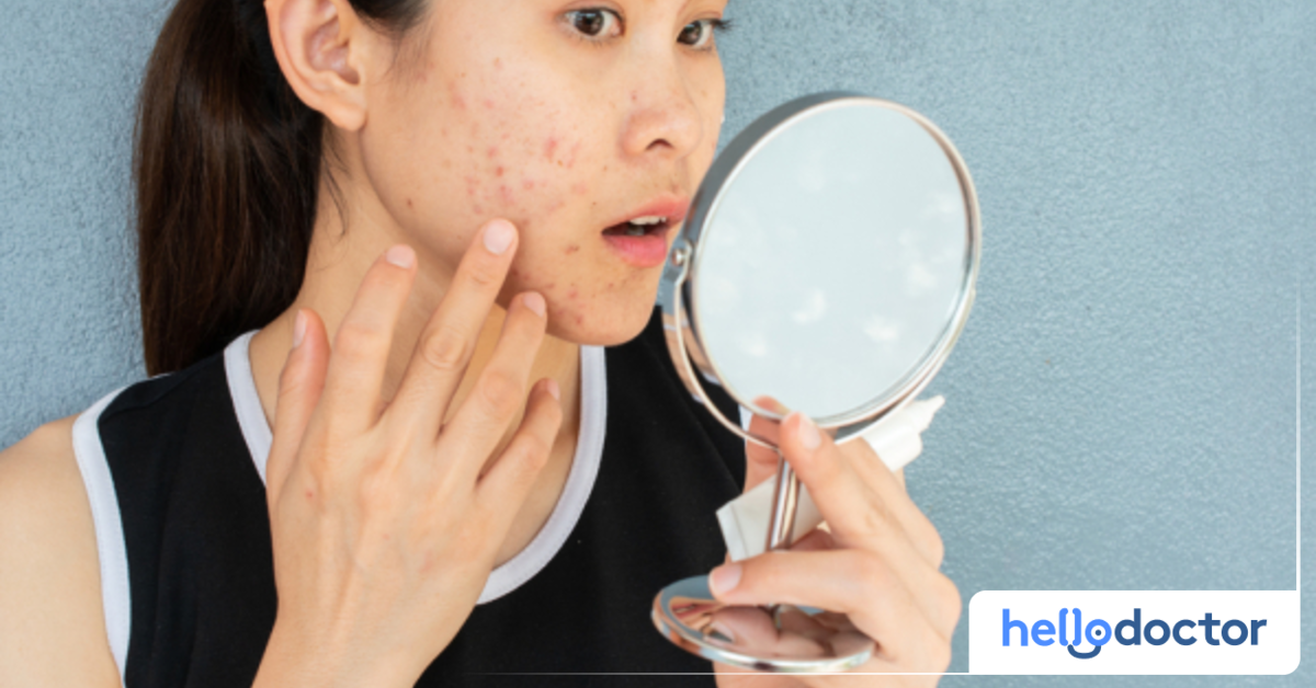 Is Kojic Acid Safe For LongTerm Skin Whitening? Learn More Here